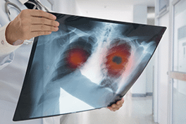 Doctor-holding-lunch-xray-image-min