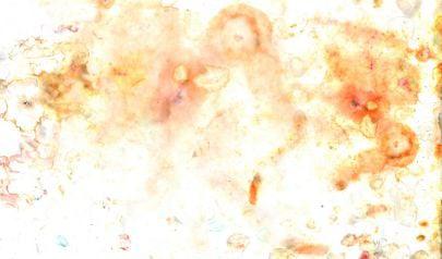 Paying a Mold Tax in Fairfield by Not Acting on Mold Removal
