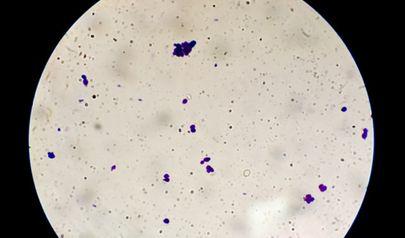 Recommendations for Mold Inspection in Sandy Springs