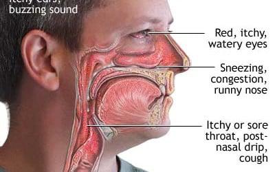 What Are The Effects of Toxic Mold Exposure