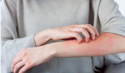 How To Treat My Skin Rash
